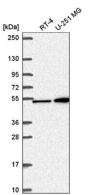 Western Blot: MKK4/MEK4 Antibody [NBP2-57194] - Western blot analysis in human cell line RT-4 and human cell line U-251 MG.