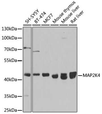 Western Blot: MKK4/MEK4 Antibody [NBP3-03652] - Analysis of extracts of various cell lines, using MKK4/MEK4 antibody at 1:1000 dilution. Secondary antibody: HRP Goat Anti-Rabbit IgG (H+L) at 1:10000 dilution. Lysates/proteins: 25ug per lane. Blocking buffer: 3% nonfat dry milk in TBST. Detection: ECL Basic Kit.