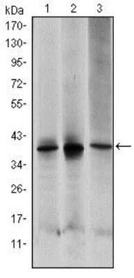 Western Blot: MKK6/MEK6 Antibody (3H12C8) [NBP2-37638] - Western blot analysis using MAP2K6 mouse mAb against HepG2 (1), MCF-7 (2) and NIH/3T3 (3) cell lysate.
