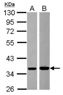 Western Blot: MKK6/MEK6 Antibody [NBP2-17271] - Sample (30 ug of whole cell lysate) A: A431 B: Raji 10% SDS PAGE gel, diluted at 1:1000.