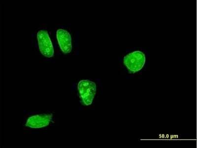 Immunocytochemistry/Immunofluorescence: MKK7/MEK7 Antibody (2G5) [H00005609-M04] - Analysis of monoclonal antibody to MAP2K7 on HeLa cell. Antibody concentration 10 ug/ml