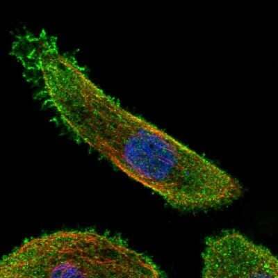 Immunocytochemistry/Immunofluorescence: MKK7/MEK7 Antibody [NBP2-56278] - Staining of human cell line PC-3 shows localization to plasma membrane & cytosol.