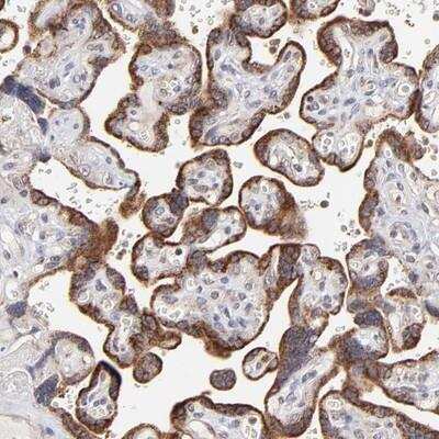 Immunohistochemistry: MKK7/MEK7 Antibody [NBP1-87792] - Staining of human placenta shows strong cytoplasmic positivity in trophoblastic cells.