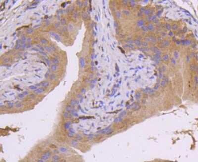 Immunohistochemistry-Paraffin: MKK7/MEK7 Antibody (SD20-87) [NBP2-67764] - Analysis of paraffin-embedded mouse bladder tissue using anti-MEK7 antibody. Counter stained with hematoxylin.