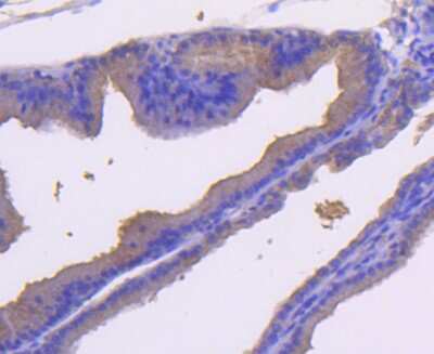 Immunohistochemistry-Paraffin: MKK7/MEK7 Antibody (SD20-87) [NBP2-67764] - Analysis of paraffin-embedded rat bladder tissue using anti-MEK7 antibody. Counter stained with hematoxylin.