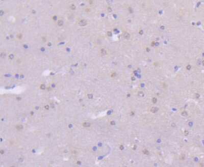 Immunohistochemistry-Paraffin: MKK7/MEK7 Antibody (SD20-87) [NBP2-67764] - Analysis of paraffin-embedded rat brain tissue using anti-MEK7 antibody. Counter stained with hematoxylin.