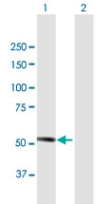 Western Blot: MKKS Antibody [H00008195-B01P] - Analysis of MKKS expression in transfected 293T cell line by MKKS polyclonal antibody.  Lane 1: MKKS transfected lysate(62.7 KDa). Lane 2: Non-transfected lysate.