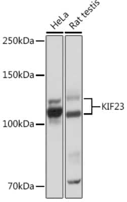 Western Blot: MKLP1 Antibody (9V4Y8) [NBP3-16507] - Western blot analysis of extracts of various cell lines, using MKLP1 Rabbit mAb (NBP3-16507) at 1:1000 dilution. Secondary antibody: HRP Goat Anti-Rabbit IgG (H+L) at 1:10000 dilution. Lysates/proteins: 25ug per lane. Blocking buffer: 3% nonfat dry milk in TBST. Detection: ECL Basic Kit. Exposure time: 10s.