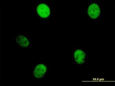 Immunocytochemistry/Immunofluorescence: MKLP1 Antibody [H00009493-B01P] - Analysis of purified antibody to KIF23 on HeLa cell. (antibody concentration 10 ug/ml)