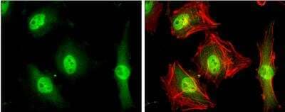 Immunocytochemistry/Immunofluorescence: MKLP1 Antibody [NBP2-17299] -  HeLa cells were fixed in 4% paraformaldehyde at RT for 15 min. Green: MKLP1 protein stained by MKLP1 antibody [N1N2], N-term diluted at 1:500. Red: phalloidin, a cytoskeleton marker, diluted at 1:200.