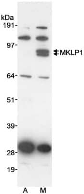 Western Blot: MKLP1 Antibody [NB100-211] - Whole cell  lysate (10 ug/lane) from asynchronous (A) or mitotically-enriched (M) HeLa cells. Mitotically enriched HeLa cells were prepared by treatment with Nocodazole (500 ng/ml; 12h). Antibody used at 1 ug/ml.