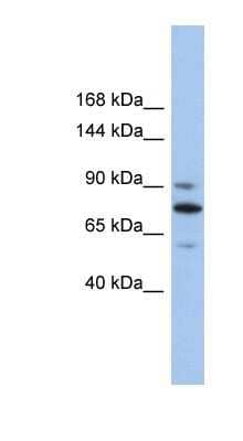 Western Blot: MKLP1 Antibody [NBP1-58126] - COLO205 cells lysate, concentration 0.2-1 ug/ml.