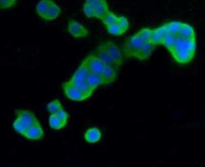 Immunocytochemistry/Immunofluorescence: MKP-3/DUSP6 Antibody (SR39-09) [NBP2-67320] - Staining DUSP6 in PC-12 cells (green). The nuclear counter stain is DAPI (blue). Cells were fixed in paraformaldehyde, permeabilised with 0.25% Triton X100/PBS.