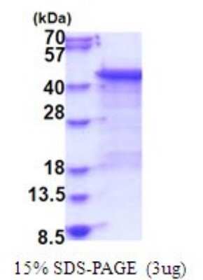 SDS-Page: MKP-3/DUSP6 Recombinant Protein [NBP2-51786] - 15% SDS Page (3 ug)