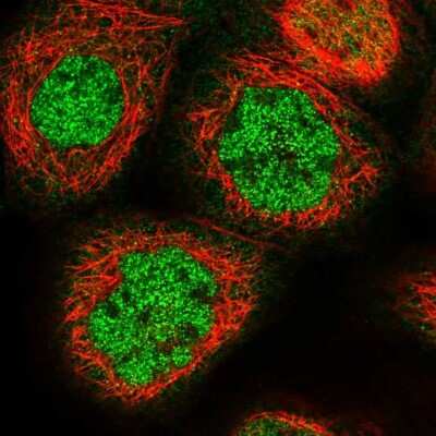 Immunocytochemistry/Immunofluorescence: MKRN2 Antibody [NBP1-83178] - Immunofluorescent staining of human cell line A-431 shows localization to nucleoplasm & cytosol.