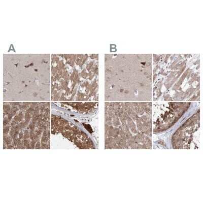 <b>Independent Antibodies Validation. </b>Immunohistochemistry-Paraffin: MKRN2 Antibody [NBP1-83178] - Staining of human cerebral cortex, heart muscle, liver and testis using Anti-MKRN2 antibody NBP1-83178 (A) shows similar protein distribution across tissues to independent antibody NBP1-83179 (B).