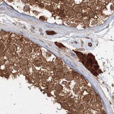 Immunohistochemistry-Paraffin: MKRN2 Antibody [NBP1-83178] - Staining of human testis.