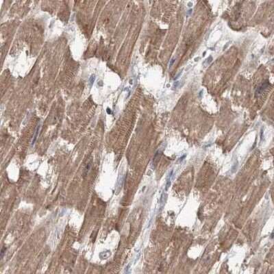 Immunohistochemistry-Paraffin: MKRN2 Antibody [NBP1-83178] - Staining of human heart muscle.