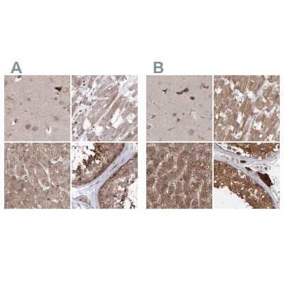 Immunohistochemistry-Paraffin MKRN2 Antibody - BSA Free