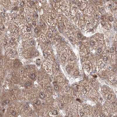 Immunohistochemistry-Paraffin: MKRN2 Antibody [NBP1-83179] - Staining of human liver.