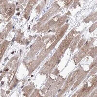 Immunohistochemistry-Paraffin: MKRN2 Antibody [NBP1-83179] - Staining of human heart muscle.