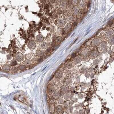 Immunohistochemistry-Paraffin: MKRN2 Antibody [NBP1-83179] - Staining of human testis.