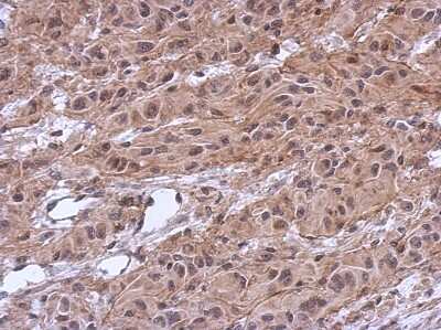 Immunohistochemistry-Paraffin: MKRN2 Antibody [NBP2-17301] - U373 xenograft, using MKRN2 antibody at 1:500 dilution.Antigen Retrieval: Trilogy™ (EDTA based, pH 8.0) buffer, 15min.
