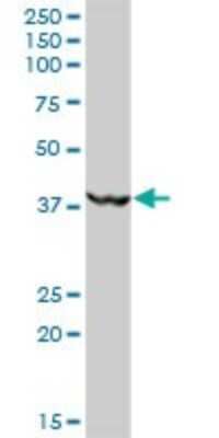 Western Blot: MKRN2 Antibody [H00023609-B01P] - Analysis of MKRN2 expression in human liver.