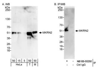 Western Blot: MKRN2 Antibody [NB100-55250] - Whole cell lysate from HeLa (5, 15 and 50 mcg for WB; 1 mg for IP, 20% of IP loaded), 293T (T; 50 mcg) and mouse NIH3T3 (M; 50 mcg) cells.  NB100-55250 used for WB at 0.1 mcg/ml (A) and 1 mcg/ml (B), and used for IP at 3 mcg/mg lysate (B).