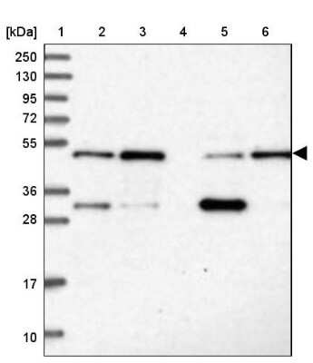 Western Blot: MKRN2 Antibody [NBP1-83179] - Lane 1: Marker  [kDa] 250, 130, 95, 72, 55, 36, 28, 17, 10.  Lane 2: Human cell line RT-4.  Lane 3: Human cell line U-251MG sp.  Lane 4: Human plasma (IgG/HSA depleted).  Lane 5: Human liver tissue.  Lane 6: Human tonsil tissue