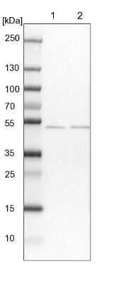<b>Independent Antibodies Validation. </b>Western Blot: MKRN2 Antibody [NBP1-83179] - Lane 1: NIH-3T3 cell lysate (Mouse embryonic fibroblast cells). Lane 2: NBT-II cell lysate (Rat Wistar bladder tumor cells).