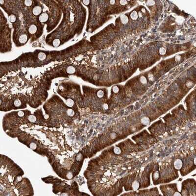 Immunohistochemistry-Paraffin: MKRN3 Antibody [NBP1-84320] - Staining of human duodenum shows strong cytoplasmic positivity in glandular cells.
