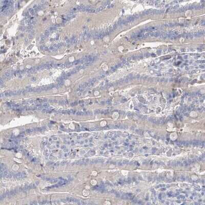 Immunohistochemistry-Paraffin MLC1SA Antibody - BSA Free