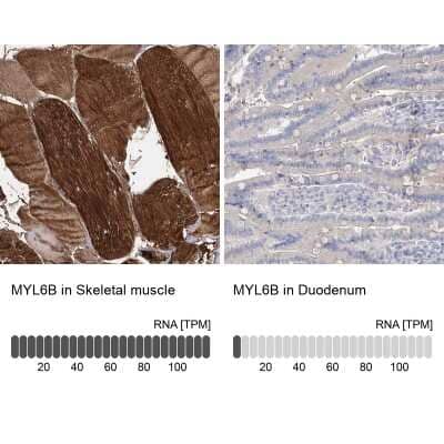 Immunohistochemistry-Paraffin MLC1SA Antibody - BSA Free