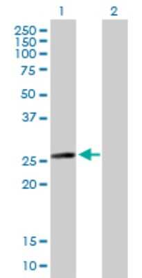 Western Blot: MLC1SA Antibody [H00140465-B01P] - Analysis of MYL6B expression in transfected 293T cell line by MYL6B polyclonal antibody.  Lane 1: MLC1SA transfected lysate(22.88 KDa). Lane 2: Non-transfected lysate.