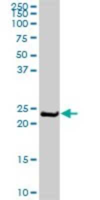 Western Blot: MLC1SA Antibody [H00140465-D01P] - Analysis of MYL6B expression in mouse testis.