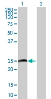 Western Blot: MLC1SA Antibody [H00140465-D01P] - Analysis of MYL6B expression in transfected 293T cell line by MYL6B polyclonal antibody.Lane 1: MYL6B transfected lysate(22.80 KDa).Lane 2: Non-transfected lysate.