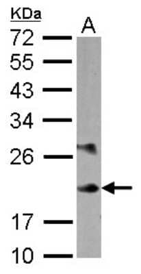 Western Blot: MLC1SA Antibody [NBP2-17304] - Sample (30 ug of whole cell lysate) A: K562 12% SDS PAGE gel, diluted at 1:10000.