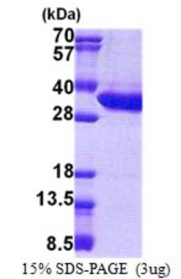 SDS-Page: MLEC Protein [NBP2-23213]