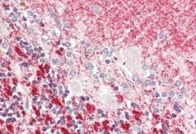 Immunohistochemistry: MLF1 Interacting Protein Antibody - N-terminal [NB110-85541] - Tissue: brain, cerebellum. Fixation: formalin fixed paraffin embedded. Primary antibody: Anti-MLF1 at 5 ug/mL for 1 h at RT. Secondary antibody: Peroxidase rabbit secondary antibody at 1:10,000 for 45 min at RT. Staining: MLF1 as precipitated red signal with hematoxylin purple nuclear counterstain.