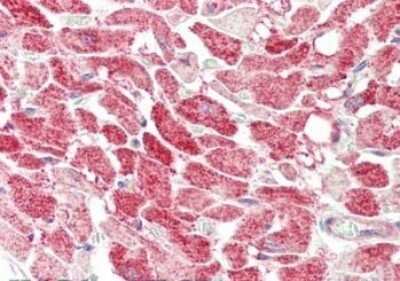 Immunohistochemistry: MLF1 Interacting Protein Antibody - N-terminal [NB110-85541] - Tissue: heart. Fixation: formalin fixed paraffin embedded. Primary antibody: Anti-MLF1 at 5 ug/mL for 1 h at RT. Secondary antibody: Peroxidase rabbit secondary antibody at 1:10,000 for 45 min at RT. Staining: MLF1 as precipitated red signal with hematoxylin purple nuclear counterstain.