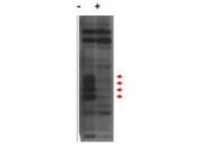 Western Blot: MLF1 Interacting Protein Antibody - N-terminal [NB110-85541] - Analysis of endogenous MLF1IP protein (a tier of four modified protein bands indicated by the arrowheads) in lysates of Hela cells (- lane). Cells treated with MLF1IP / PBIP1 shRNA (+ lane) show no staining. The identities of the higher and lower molecular weight bands are unknown. Primary antibody was used at 1:1,000.