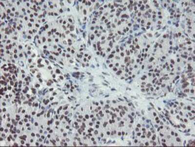 Immunohistochemistry-Paraffin: MLF2 Antibody (1E3) [NBP2-03726] - Staining of paraffin-embedded Human pancreas tissue using anti-MLF2 mouse monoclonal antibody.