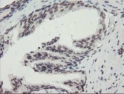 Immunohistochemistry-Paraffin: MLF2 Antibody (1E3) [NBP2-03726] Staining of paraffin-embedded Human prostate tissue using anti-MLF2 mouse monoclonal antibody.