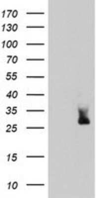 Western Blot: MLF2 Antibody (1E3) [NBP2-03726] - HEK293T cells were transfected with the pCMV6-ENTRY control (Left lane) or pCMV6-ENTRY MLF2 (Right lane) cDNA for 48 hrs and lysed. Equivalent amounts of cell lysates (5 ug per lane) were separated by SDS-PAGE and immunoblotted with anti-MLF2.