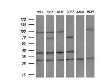 Western Blot: MLF2 Antibody (1E3) [NBP2-03726] -  Analysis of extracts (10ug) from 6 different cell lines by using anti-MLF2 monoclonal antibody.(1:200)