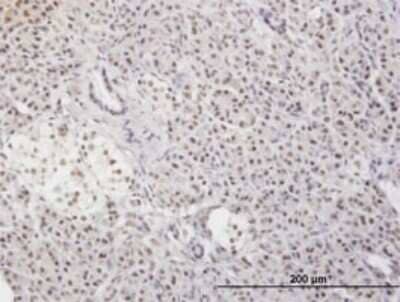 Immunohistochemistry-Paraffin: MLF2 Antibody (2F6-1E3) [H00008079-M01] - Analysis of monoclonal antibody to MLF2 on formalin-fixed paraffin-embedded human pancreas. Antibody concentration 3 ug/ml.