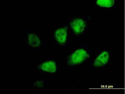 Immunocytochemistry/Immunofluorescence: MLF2 Antibody [H00008079-B01P] - Analysis of purified antibody to MLF2 on HeLa cell. (antibody concentration 10 ug/ml)