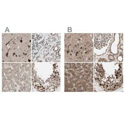 Immunohistochemistry-Paraffin: MLF2 Antibody [NBP1-82518] - Staining of human cerebral cortex, kidney, liver and testis using Anti-MLF2 antibody NBP1-82518 (A) shows similar protein distribution across tissues to independent antibody NBP1-82519 (B).