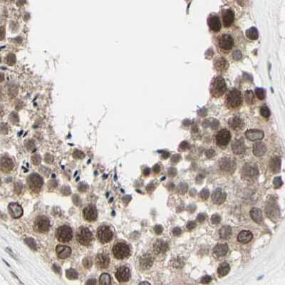 Immunohistochemistry-Paraffin: MLF2 Antibody [NBP1-82518] - Staining of human testis.